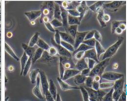 人肝癌细胞；Hep3B