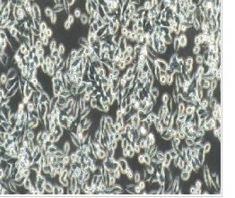 人结肠癌细胞；SW620