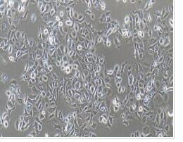 人膀胱移行细胞癌细胞；SW780