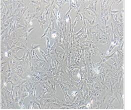 人脑胶质母细胞瘤细胞；T98G