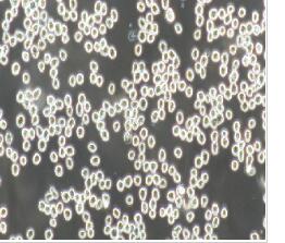 人血液白血病细胞；TF-1