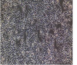 人甲状腺导管癌细胞；TT