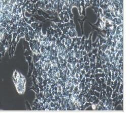 人神经上皮瘤细胞；SK-N-MC