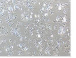 人胃癌细胞；SNU-1