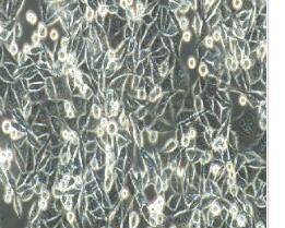 人结肠腺癌细胞；SW48