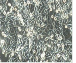 人结肠腺癌细胞；SW480