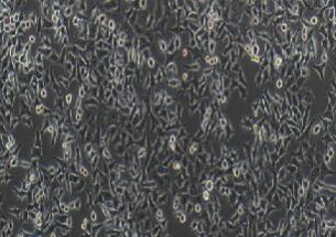 人前列腺癌细胞；PC3