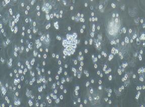 人Burkitt’s淋巴瘤细胞；Raji