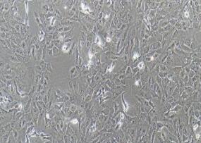 人胆管细胞型肝癌细胞；RBE