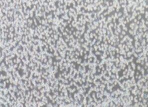 人急性非B非T淋巴细胞白血病细胞；Reh