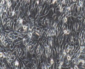 大鼠肾上腺嗜铬细胞(高分化)；PC-12