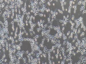 小鼠胚胎成纤维细胞；NIH/3T3