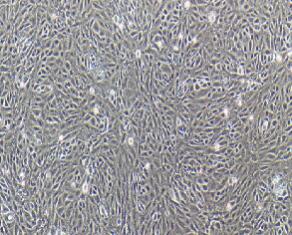 小鼠肾小球系膜细胞；SV40 MES 13