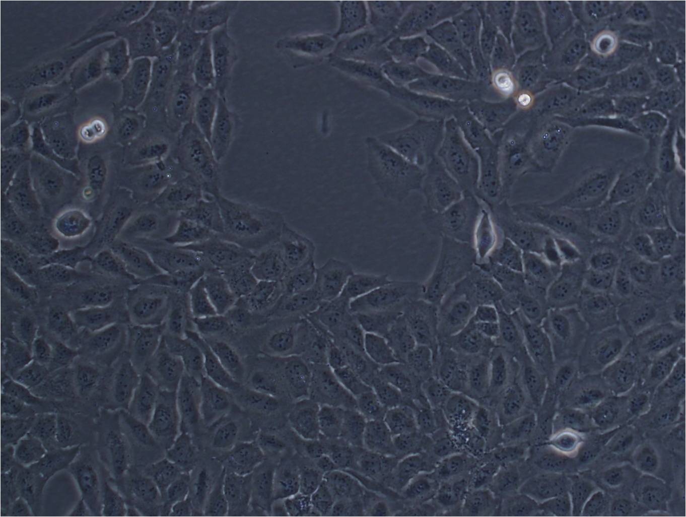 HMEC-1 Cell:人微血管内皮细胞系