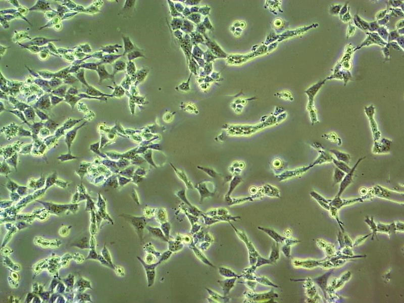 ETCC007 Cell:人乳腺导管癌细胞系