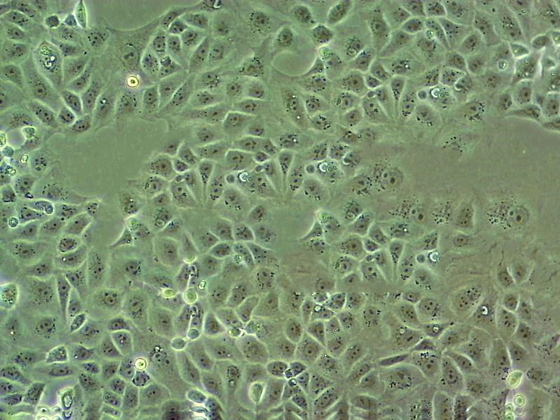 SUM159PT Cell:人乳腺癌细胞系