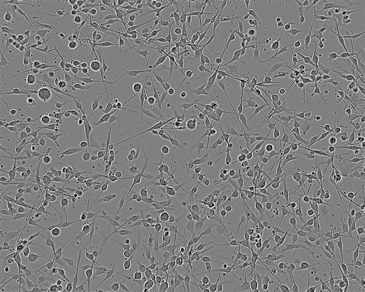 SHIN-3 Cell:人卵巢浆液性囊腺癌细胞系