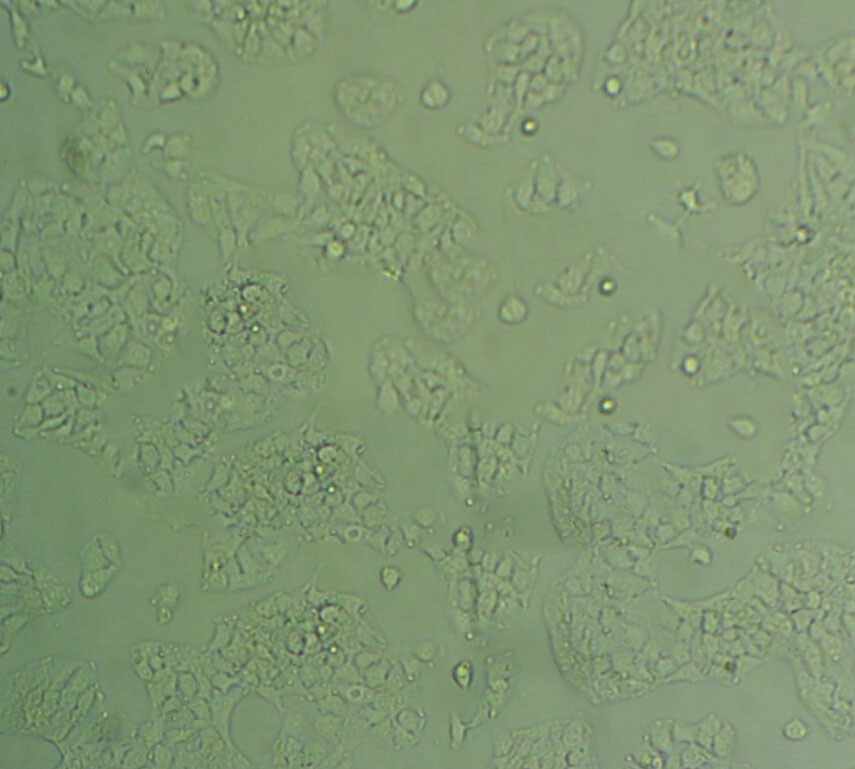 U14 Cell:小鼠宫颈癌细胞系