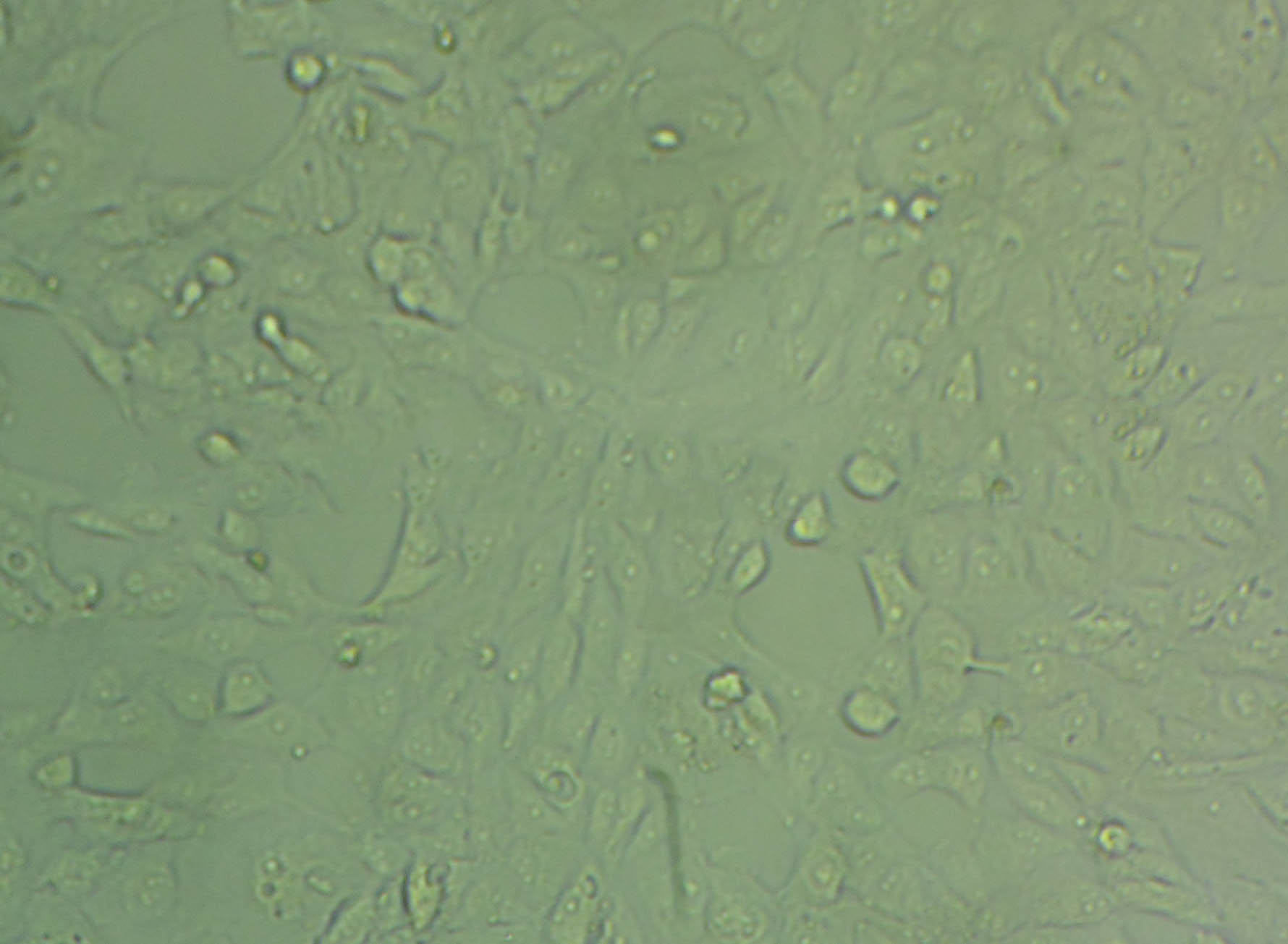 NMC-G1 Cell:人脑胶质细胞系