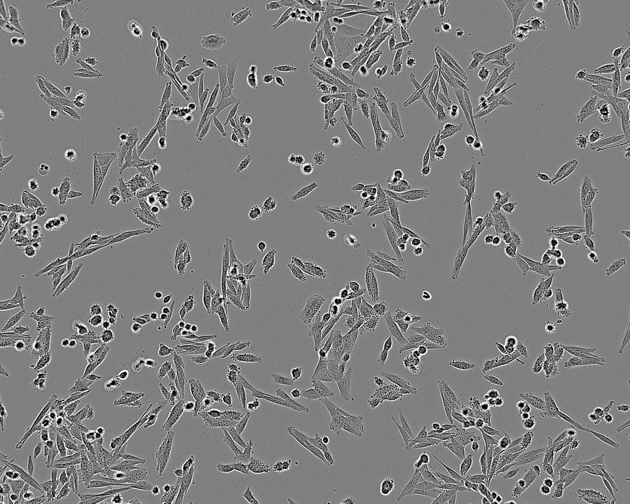 TSCC1 Cell:人源口腔鳞状细胞系