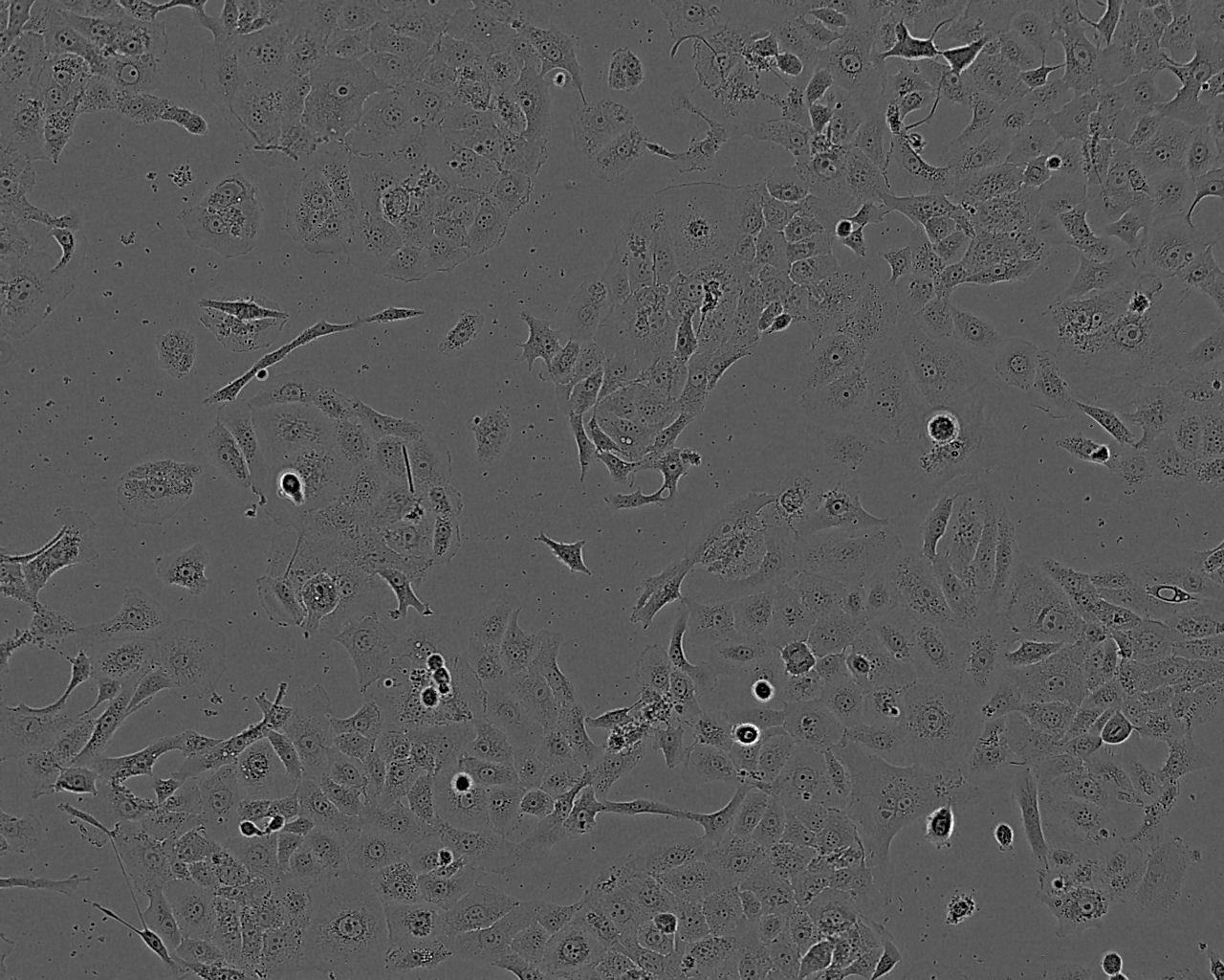 COLO 394 Cell:人结肠癌细胞系