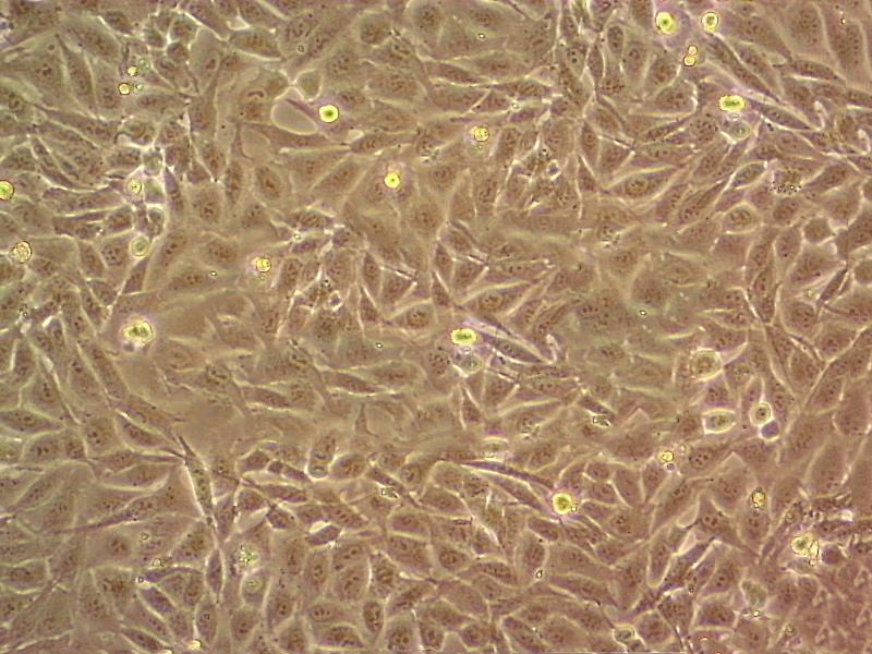 HCC2935 Cell:人肺癌细胞系