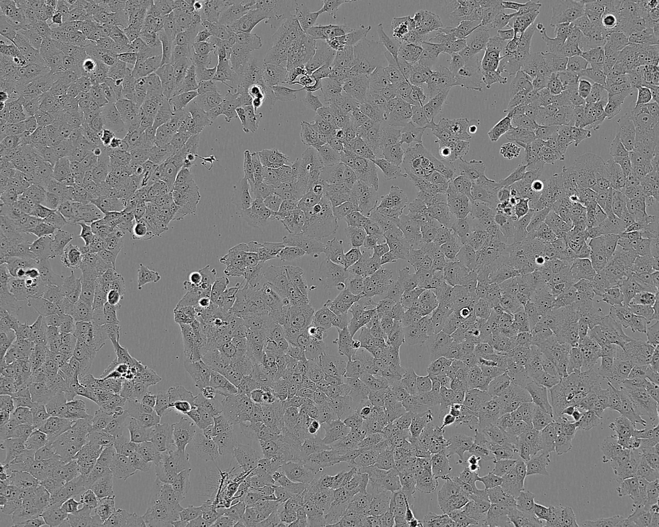 NCI-H2342 Cell:人非小细胞肺癌细胞系
