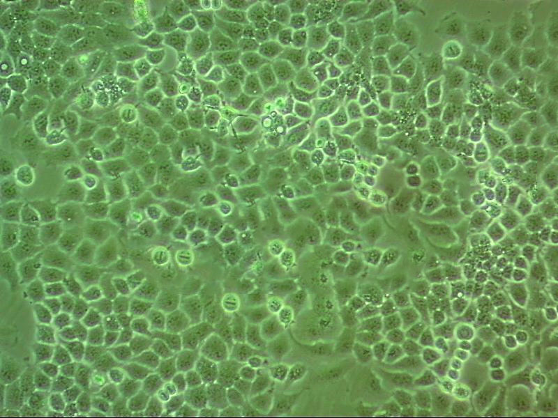 NCI-H2141 Cell:人小细胞肺癌细胞系