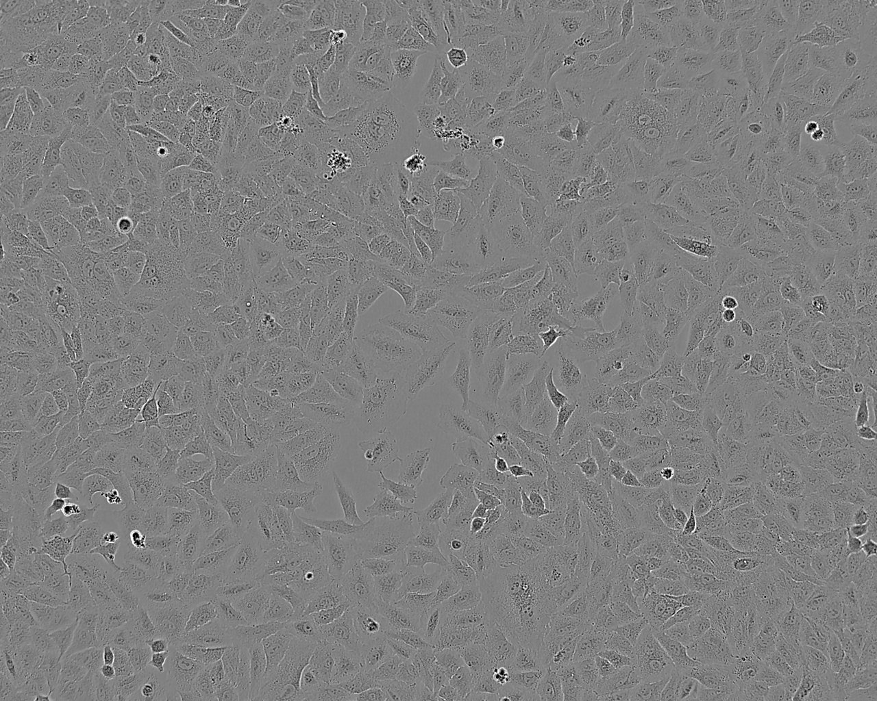 NCI-H2196 Cell:人小细胞肺癌细胞系