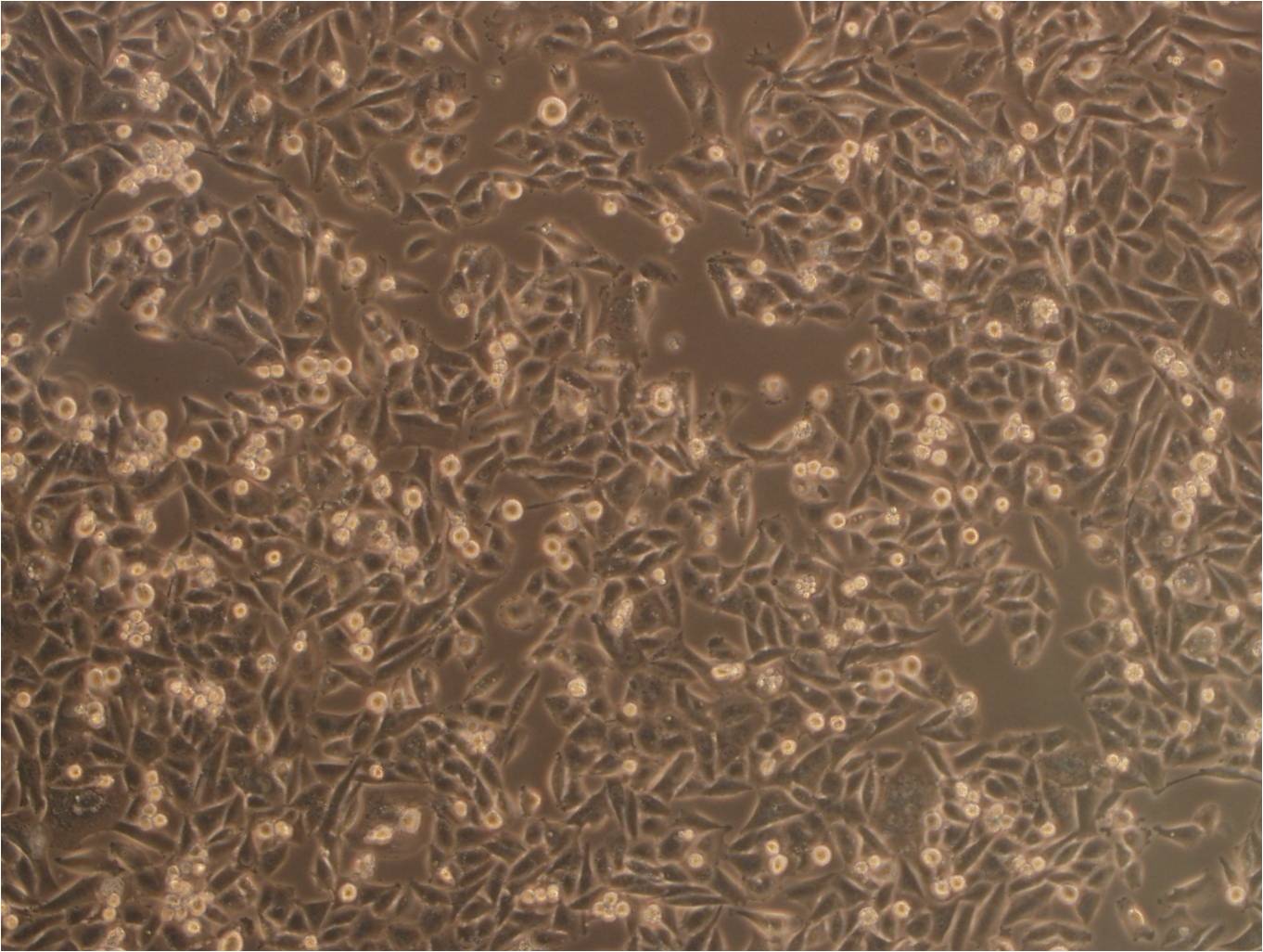 NCI-H841 Cell:人小细胞肺癌细胞系