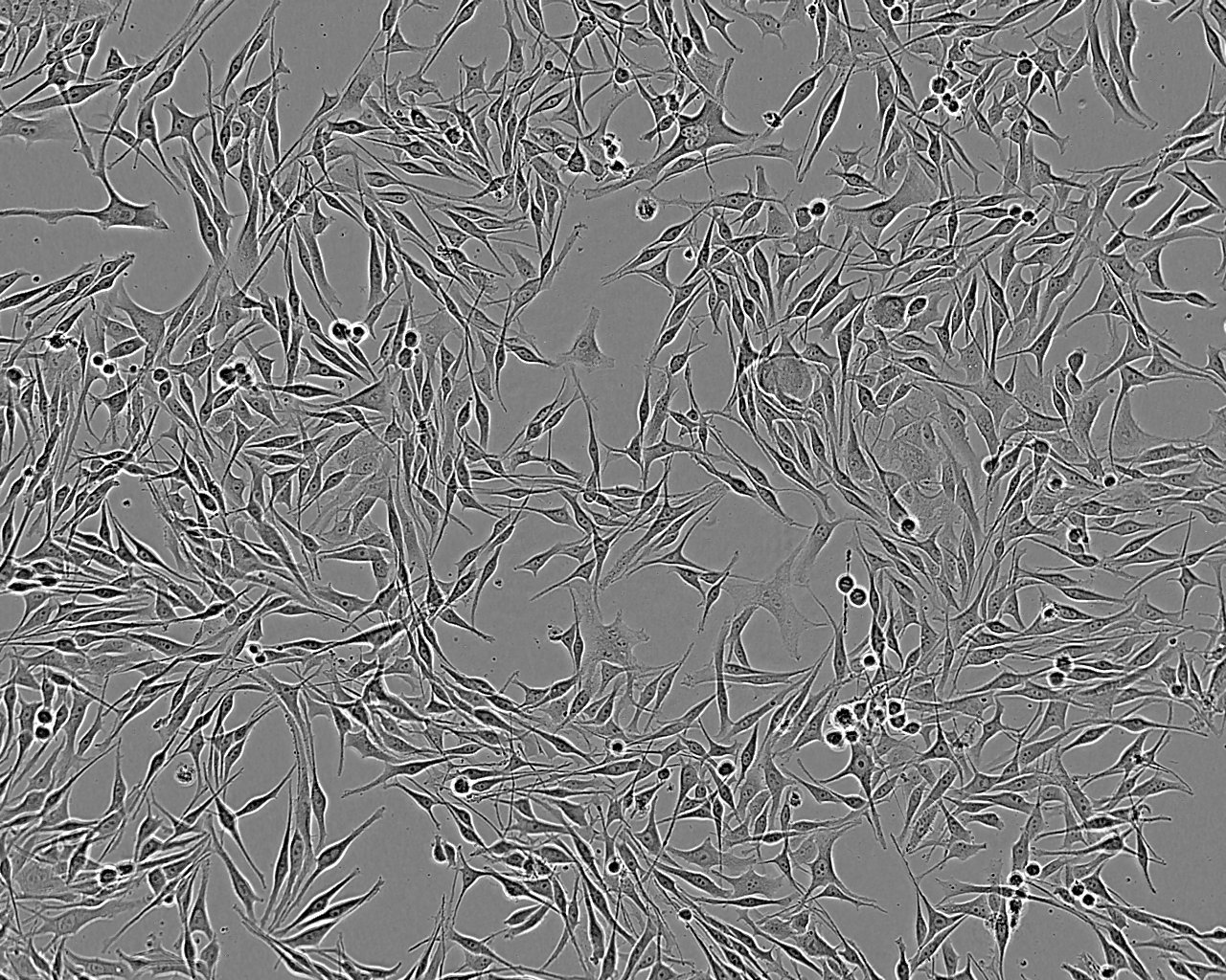 ESC-410 Cell:人食管癌细胞系
