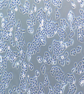 人肝癌亚力山大细胞；PLC/PRF/5