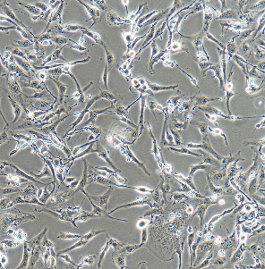 人舌鳞癌细胞；SCC-9