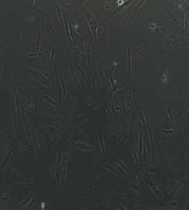 人神经母细胞瘤细胞；SH-SY5Y