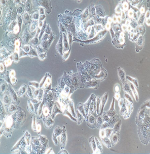 人小细胞肺癌细胞骨转移；NCI-H526