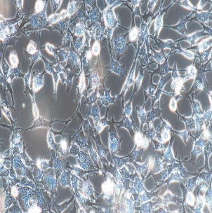 人肾上腺皮质腺癌细胞；NCI-H295R