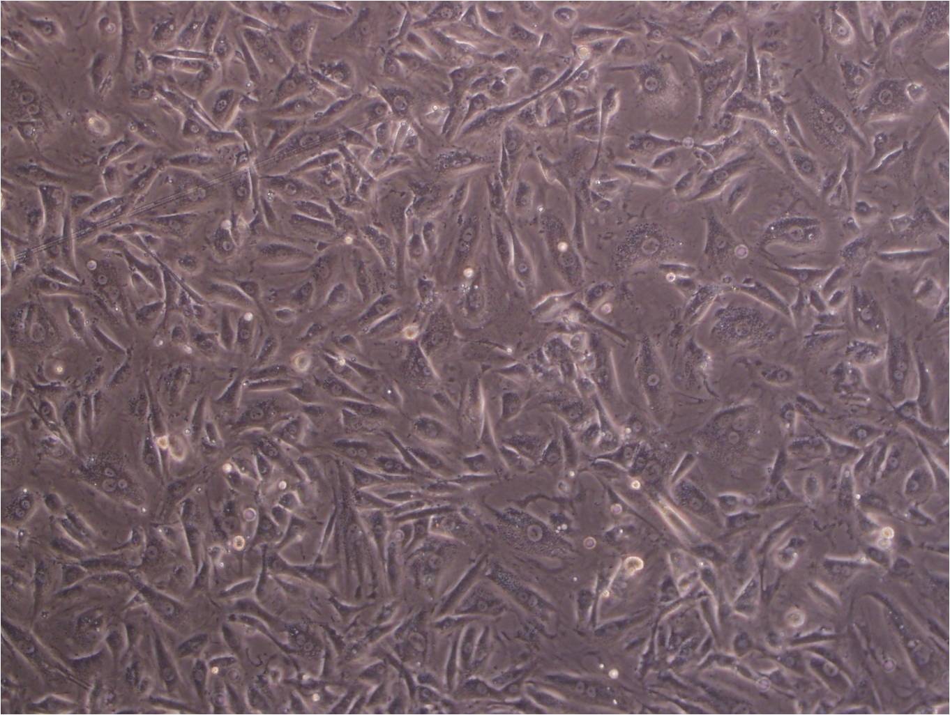 NIT-1 Cell:小鼠胰腺β细胞系