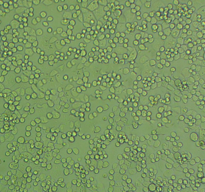 C666-1 Cell:人鼻咽癌细胞系