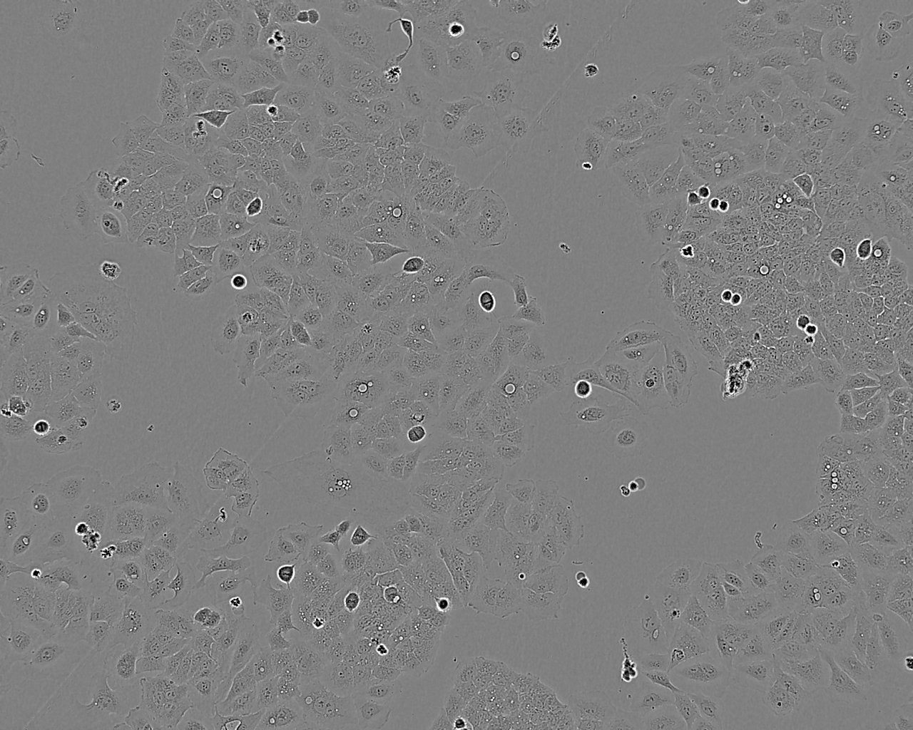 SV40 MES 13 Cell:小鼠肾小球系膜细胞系