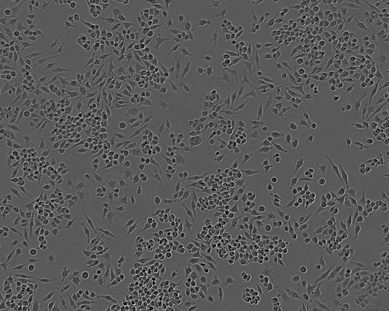 HCT 116 Cell:人结肠癌细胞系