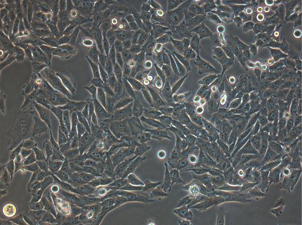 HCC1171 Cell:人肺癌腺癌细胞系