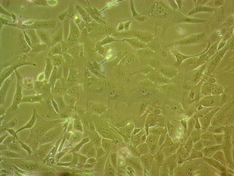 MEC-1 Cell:人粘液表皮样癌细胞系