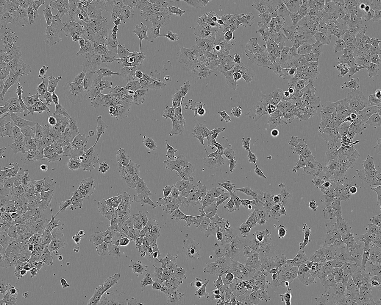 Vx2 Cell:兔间变表皮鳞癌瘤细胞系