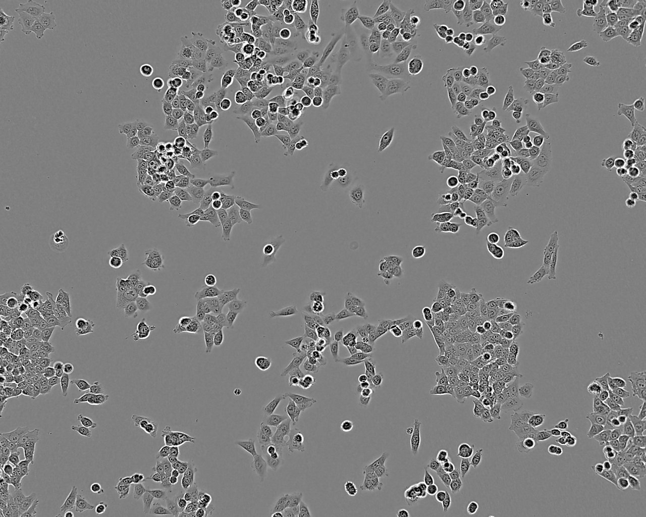 NCI-H929 Cell:人浆细胞白血病细胞系