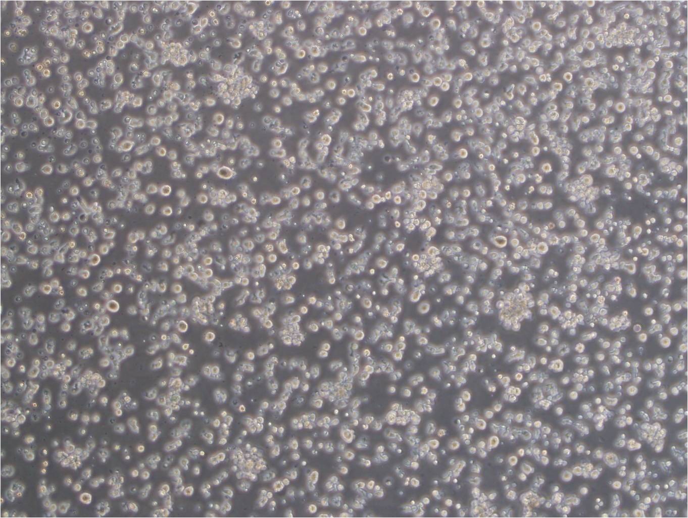 Karpas-299 Cell:人间变性大细胞淋巴瘤细胞系