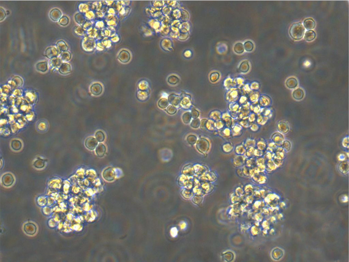 1301 Cell:人急性T淋巴细胞白血病细胞系
