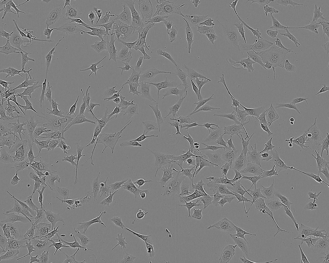 DLD-1 epithelioid cells人结直肠腺癌上皮细胞系