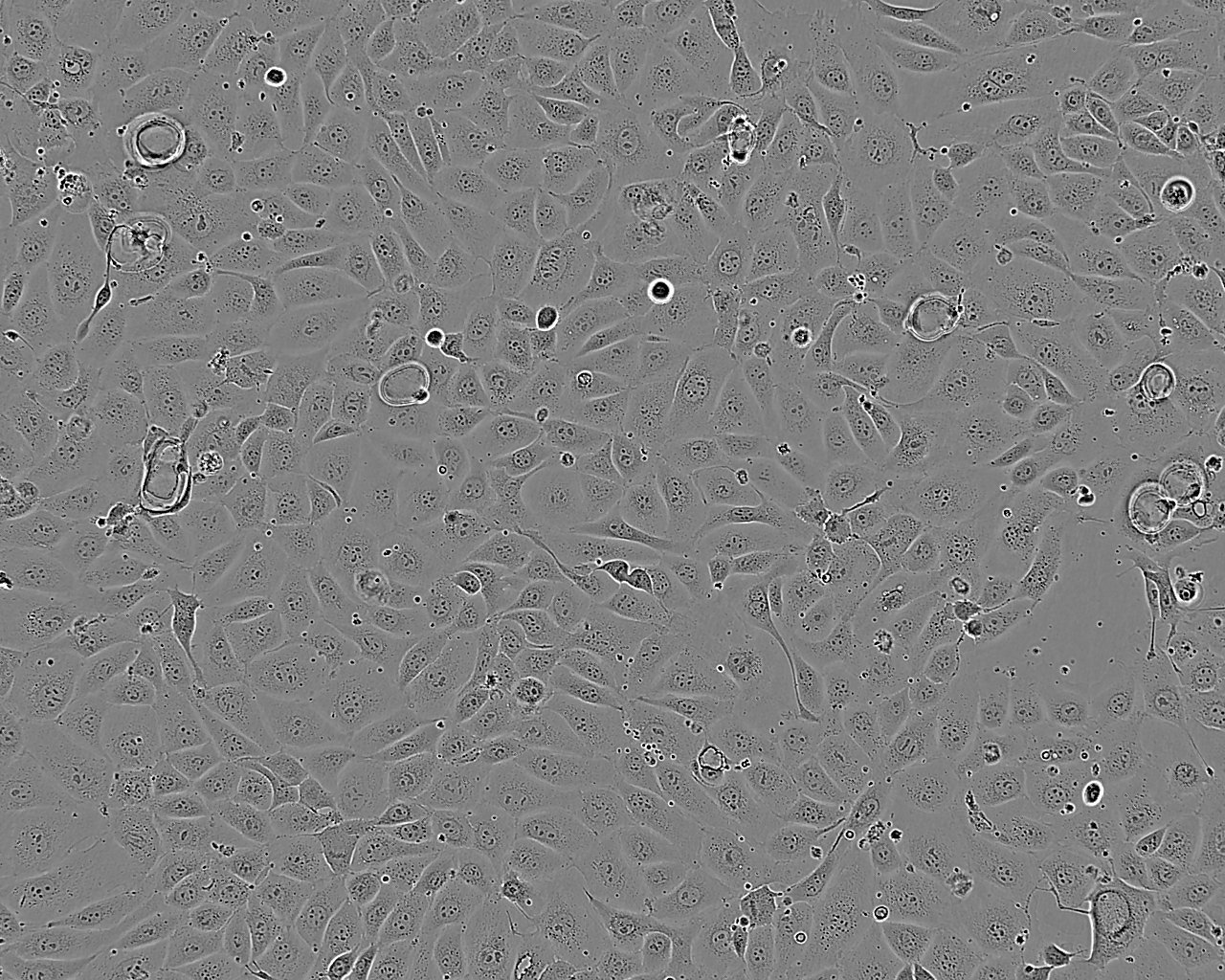 LoVo epithelioid cells人结肠癌细胞系