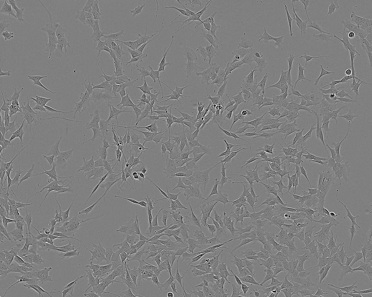 Huh-7 epithelioid cells人肝癌细胞系