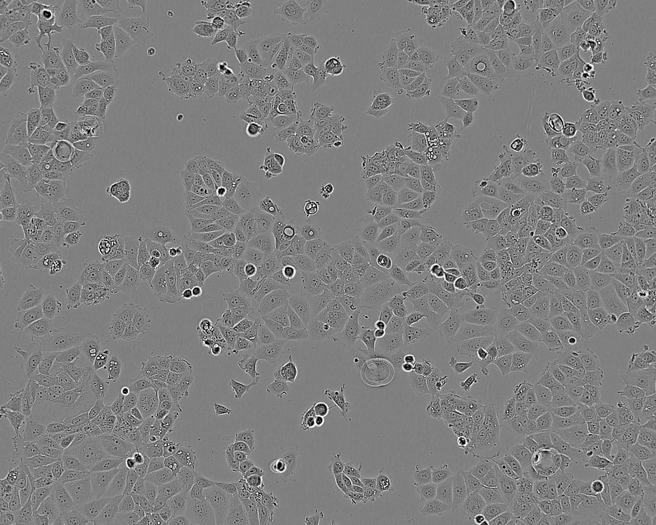 MDA-MB-175-VII epithelioid cells人乳腺导管癌细胞系